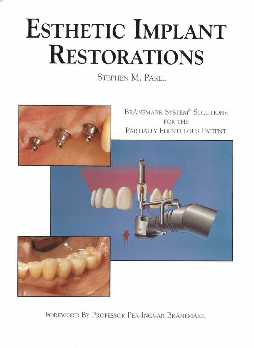 Esthetic Implant Restoration Branemark System Solutions for the Partially Edentulous Patient