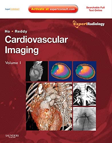 Book cover for Cardiovascular Imaging, 2-Volume Set: Expert Radiology Series by Ho MD  MBA, Vincent